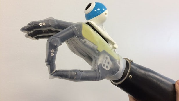 Image of prosthetic hand with webcam 